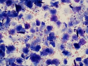 パップスミアの結果